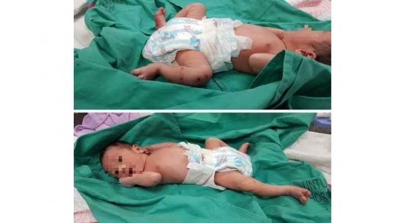 Baby boy abandoned, found with dog bites in Malaysia