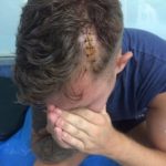 German tourist attacked, nearly killed in Phuket