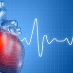 Should you book a heart scan?