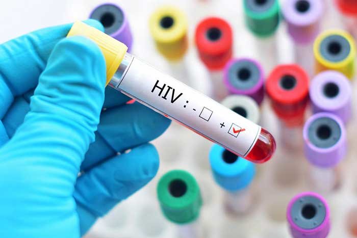 About 77,000 people with HIV live in Bangkok
