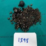 Doctors find nearly 2,000 gallstones in a woman’s stomach