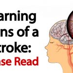 Please Read–Warning Signs of a Stroke