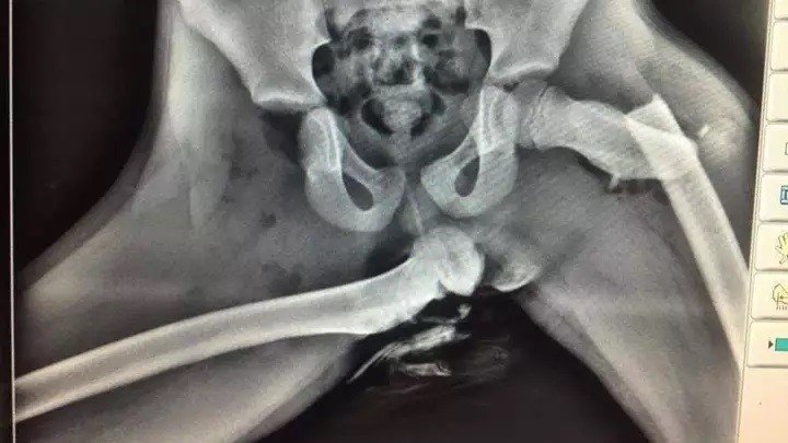 Horrific X-Ray Image