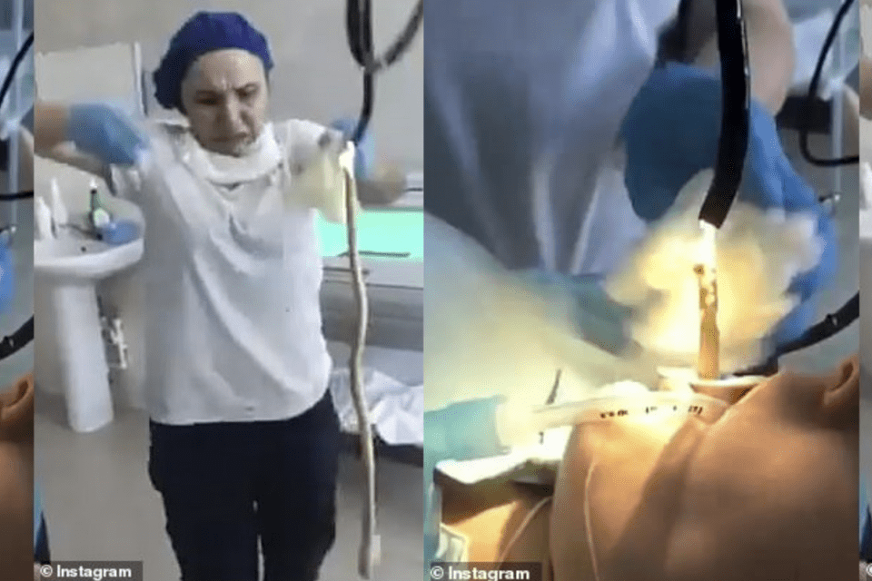 Shocking Moment 4ft Snake Pulled From Woman's Throat