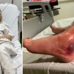Brit backpacker almost loses leg after bite from deadly spider