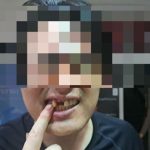 Korean Tourist Loses Three Teeth