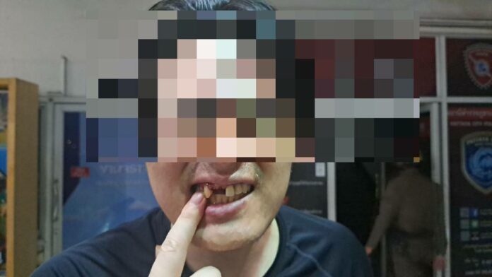 Korean Tourist Loses Three Teeth