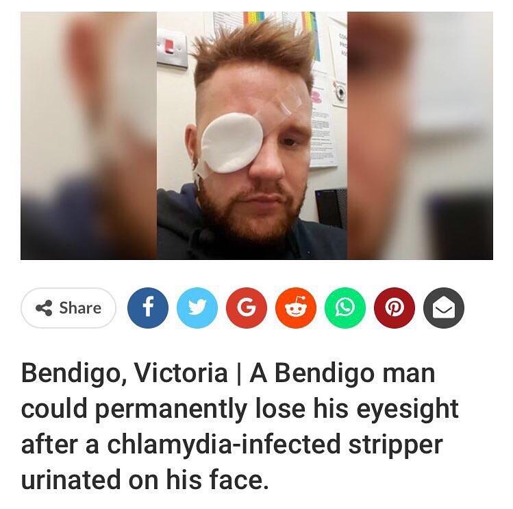 Aussie Man Goes Blind After Stripper Pees in His Eye