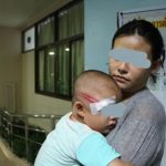 2 year old baby severely injured