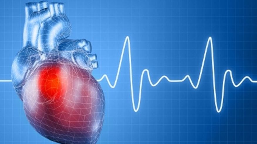 Should you book a heart scan?