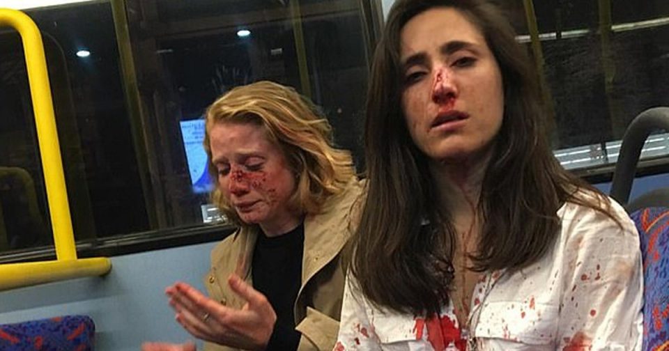 Lesbian Couple Attacked After Refusing To Kiss For Gang’s Entertainment