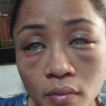 Woman BLINDED by boyfriend’s secret gay lover