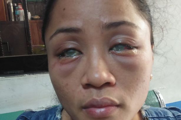 Woman BLINDED by boyfriend’s secret gay lover