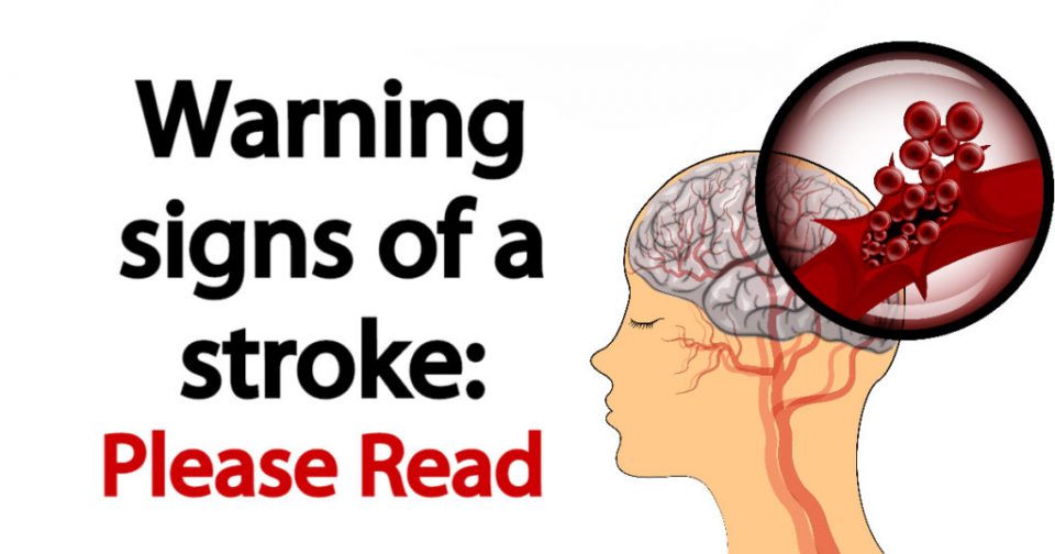 Please Read–Warning Signs of a Stroke