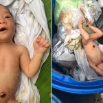 Baby girl thrown in the Bangkok trash SURVIVES
