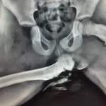 Horrific X-Ray Image
