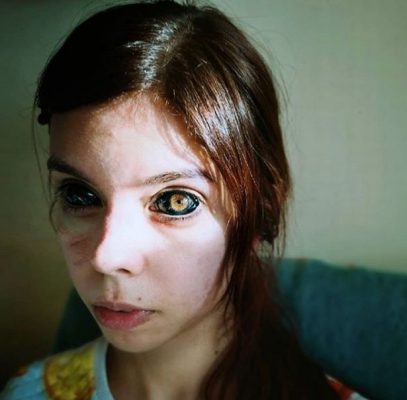 girl has tattooed eyeballs