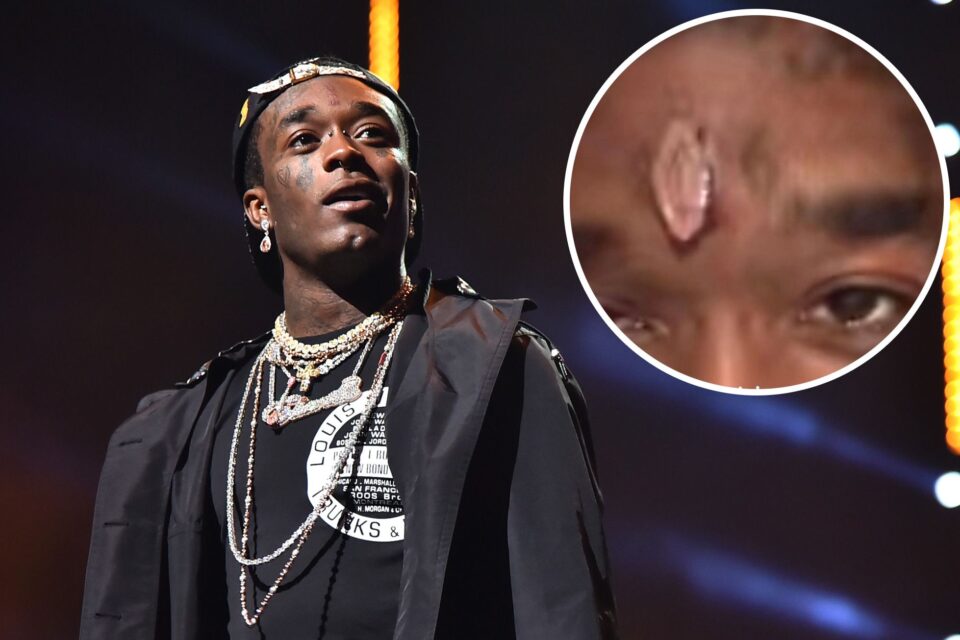 Lil Uzi Vert Gets A 24 Million Pink Diamond Embedded In His Forehead