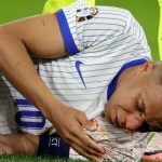 Kylian Mbappe Doubtful for Euro 2024 After Nose Surgery
