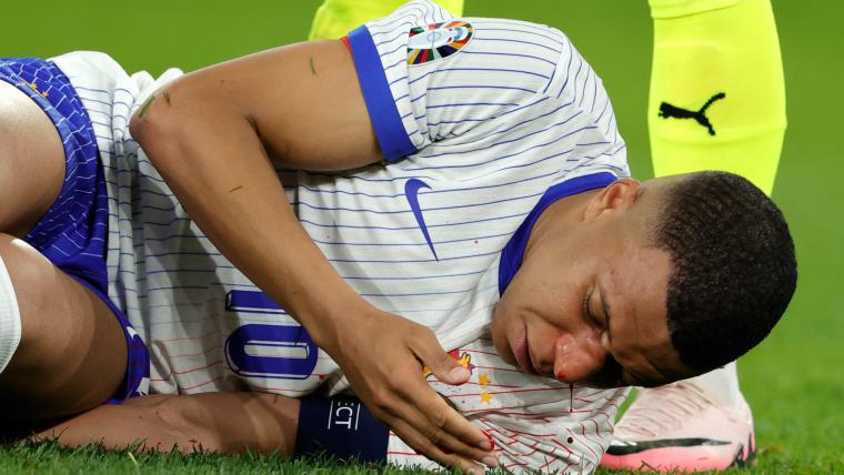 Kylian Mbappe Doubtful for Euro 2024 After Nose Surgery