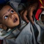 The Role of Caste in India's Child Stunting Crisis