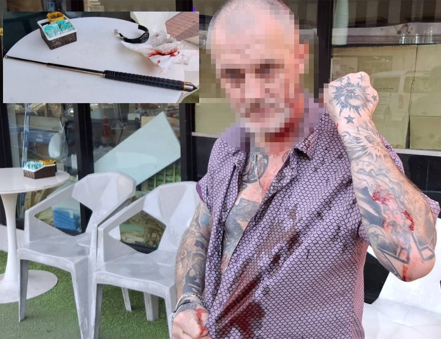 Thai man attacks British tourist with metal Rod